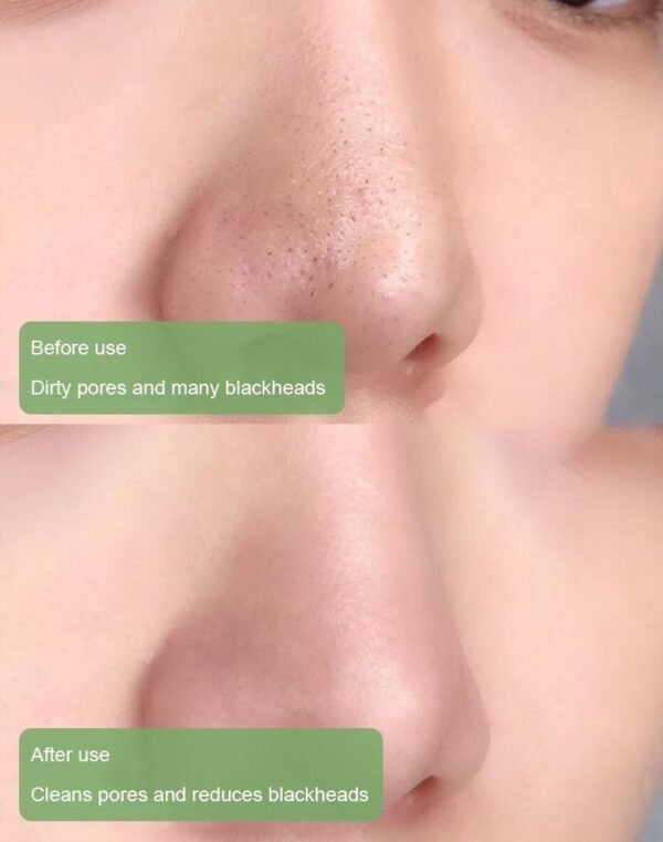 Hot Sale - Poreless Deep Cleanse Green Tea Mask - Image 13
